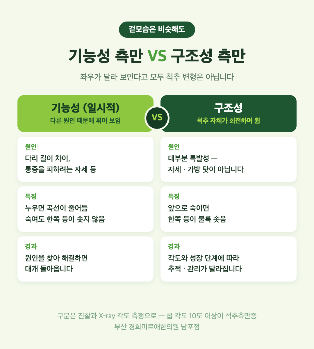 기능성 측만과 구조성 측만 차이 — 청소년 척추측만증 감별 인포그래픽